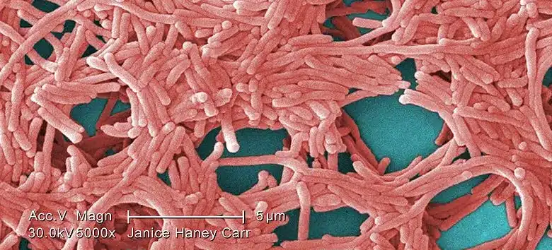 legionella